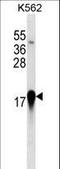 Eukaryotic Translation Initiation Factor 4E Binding Protein 1 antibody, LS-C167708, Lifespan Biosciences, Western Blot image 