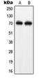 Neurofilament Light antibody, orb214301, Biorbyt, Western Blot image 