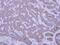 Insulin Like Growth Factor Binding Protein 2 antibody, PA5-29741, Invitrogen Antibodies, Immunohistochemistry paraffin image 