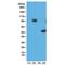 His tag antibody, GTX33607, GeneTex, Western Blot image 