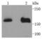 Histone-lysine N-methyltransferase NSD3 antibody, A32443, Boster Biological Technology, Western Blot image 