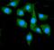 Heat Shock Protein 90 Alpha Family Class A Member 1 antibody, M01103-4, Boster Biological Technology, Immunofluorescence image 
