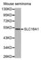 Solute Carrier Family 16 Member 1 antibody, abx002186, Abbexa, Western Blot image 