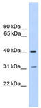Phosphatase, Orphan 2 antibody, TA345718, Origene, Western Blot image 