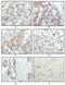 Ribosomal Protein S6 Kinase A1 antibody, NBP1-47405, Novus Biologicals, Immunohistochemistry paraffin image 