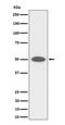 FGFR1 Oncogene Partner antibody, M06907, Boster Biological Technology, Western Blot image 