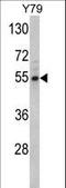 Fascin Actin-Bundling Protein 1 antibody, LS-C166053, Lifespan Biosciences, Western Blot image 