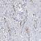 Chromosome 12 Open Reading Frame 65 antibody, PA5-58288, Invitrogen Antibodies, Immunohistochemistry paraffin image 