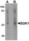 Serum/Glucocorticoid Regulated Kinase 1 antibody, PA5-21147, Invitrogen Antibodies, Western Blot image 
