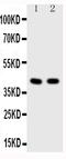 Histone Deacetylase 8 antibody, PA1591, Boster Biological Technology, Western Blot image 