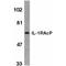 Interleukin 1 Receptor Accessory Protein antibody, PA1-30896, Invitrogen Antibodies, Western Blot image 