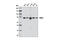 DEAD-Box Helicase 3 X-Linked antibody, 8192S, Cell Signaling Technology, Western Blot image 
