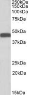 Arrestin Beta 2 antibody, PA5-18375, Invitrogen Antibodies, Western Blot image 