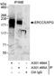 ERCC Excision Repair 5, Endonuclease antibody, A301-485A, Bethyl Labs, Immunoprecipitation image 