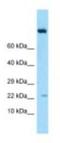 Interleukin 19 antibody, NBP1-98448, Novus Biologicals, Western Blot image 