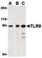 Toll Like Receptor 9 antibody, LS-B688, Lifespan Biosciences, Western Blot image 