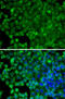 Arrestin Beta 2 antibody, 14-883, ProSci, Immunofluorescence image 