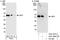 Latent membrane protein 1 antibody, A301-958A, Bethyl Labs, Western Blot image 