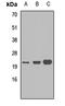 S100 Calcium Binding Protein A9 antibody, LS-C667724, Lifespan Biosciences, Western Blot image 