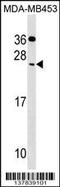 Cell Death Inducing DFFA Like Effector C antibody, 59-746, ProSci, Western Blot image 