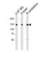 Calcium/Calmodulin Dependent Protein Kinase Kinase 2 antibody, LS-C164316, Lifespan Biosciences, Western Blot image 