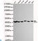 Glutamic-Oxaloacetic Transaminase 2 antibody, LS-C813275, Lifespan Biosciences, Western Blot image 