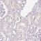 Synaptonemal Complex Central Element Protein 2 antibody, PA5-59857, Invitrogen Antibodies, Immunohistochemistry frozen image 