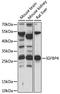 Insulin Like Growth Factor Binding Protein 4 antibody, A15068, ABclonal Technology, Western Blot image 