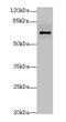 Rho Related BTB Domain Containing 3 antibody, MBS7001467, MyBioSource, Western Blot image 
