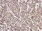 Lamin A/C antibody, NBP2-19323, Novus Biologicals, Immunohistochemistry paraffin image 