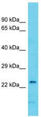 Armadillo Repeat Containing 7 antibody, TA330741, Origene, Western Blot image 