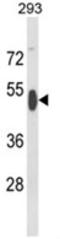 RB Binding Protein 7, Chromatin Remodeling Factor antibody, AP18177PU-N, Origene, Western Blot image 