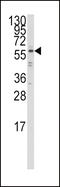 Interferon Regulatory Factor 5 antibody, MBS9213786, MyBioSource, Western Blot image 