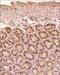 KI-67 antibody, NB110-89719, Novus Biologicals, Immunohistochemistry paraffin image 