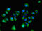 Sprouty Related EVH1 Domain Containing 1 antibody, orb53551, Biorbyt, Immunofluorescence image 
