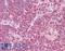 Interferon Regulatory Factor 4 antibody, LS-B7104, Lifespan Biosciences, Immunohistochemistry paraffin image 