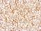 Glutamate Ionotropic Receptor NMDA Type Subunit 2A antibody, PA5-27921, Invitrogen Antibodies, Immunohistochemistry paraffin image 