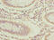 ARPIN antibody, LS-C399055, Lifespan Biosciences, Immunohistochemistry paraffin image 