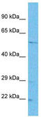 Tetratricopeptide Repeat Domain 26 antibody, TA330804, Origene, Western Blot image 