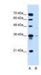Solute Carrier Family 17 Member 3 antibody, NBP1-60014, Novus Biologicals, Western Blot image 