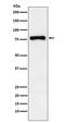 2-5A-dependent ribonuclease antibody, M02521, Boster Biological Technology, Western Blot image 