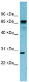 RAS Like Family 12 antibody, TA345009, Origene, Western Blot image 