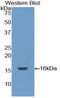 Coagulation Factor VII antibody, LS-C293396, Lifespan Biosciences, Western Blot image 