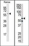 Receptor Interacting Serine/Threonine Kinase 2 antibody, AP14642PU-N, Origene, Western Blot image 