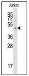 Autophagy Related 4A Cysteine Peptidase antibody, AP32201PU-N, Origene, Western Blot image 