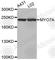 Myosin VIIA antibody, A3621, ABclonal Technology, Western Blot image 