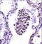 NFKB Inhibitor Beta antibody, LS-C164852, Lifespan Biosciences, Immunohistochemistry frozen image 