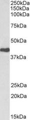 CAK antibody, NBP2-42500, Novus Biologicals, Western Blot image 