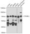 Catenin Beta Like 1 antibody, GTX32543, GeneTex, Western Blot image 