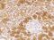 Interleukin 1 Receptor Associated Kinase 2 antibody, 205939-T08, Sino Biological, Immunohistochemistry paraffin image 